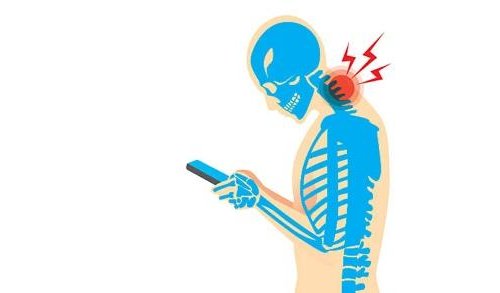Syndrome del SMS